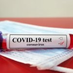 COVID-19 testing options